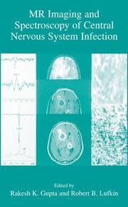 Cover von MR Imaging and Spectroscopy of Central Nervous System Infection