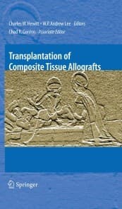 Cover von Transplantation of Composite Tissue Allografts