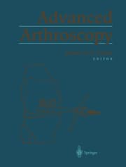 Cover von Advanced Arthroscopy