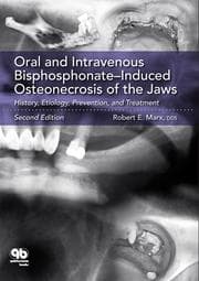 Cover von Oral and Intravenous Bisphosphonate-Induced Osteonecrosis of the Jaws