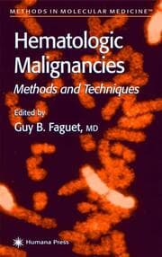 Cover von Hematologic Malignancies