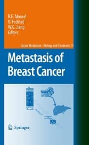 Cover von Metastasis of Breast Cancer