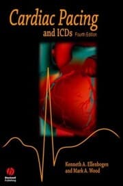 Cover von Cardiac Pacing and ICDs