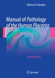 Cover von Manual of Pathology of the Human Placenta