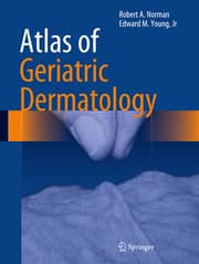 Cover von Atlas of Geriatric Dermatology