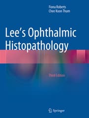 Cover von Lee's Ophthalmic Histopathology