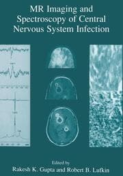 Cover von MR Imaging and Spectroscopy of Central Nervous System Infection