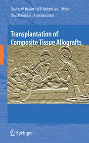 Cover von Transplantation of Composite Tissue Allografts
