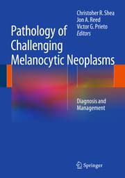 Cover von Pathology of Challenging Melanocytic Neoplasms