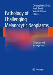 Cover von Pathology of Challenging Melanocytic Neoplasms