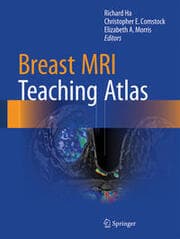 Cover von Breast MRI Teaching Atlas