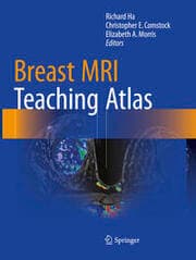 Cover von Breast MRI Teaching Atlas