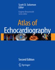 Cover von Atlas of Echocardiography