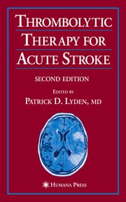 Cover von Thrombolytic Therapy for Acute Stroke