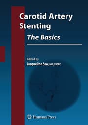 Cover von Carotid Artery Stenting