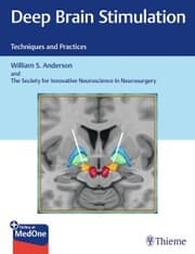 Cover von Deep Brain Stimulation