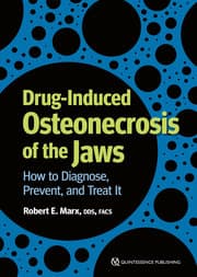 Cover von Drug-Induced Osteonecrosis of the Jaws