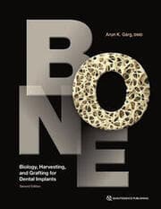 Cover von Bone