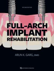 Cover von Full-Arch Implant Rehabilitation