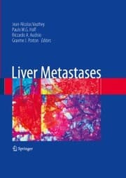 Cover von Liver Metastases