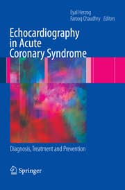 Cover von Echocardiography in Acute Coronary Syndrome