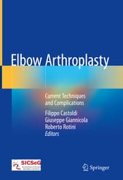 Cover von Elbow Arthroplasty