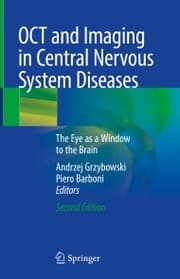 Cover von OCT and Imaging in Central Nervous System Diseases