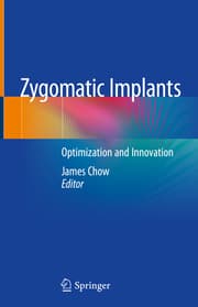 Cover von Zygomatic Implants