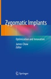 Cover von Zygomatic Implants