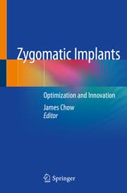 Cover von Zygomatic Implants