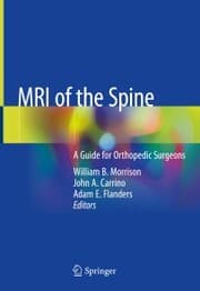 Cover von MRI of the Spine