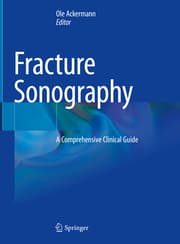 Cover von Fracture Sonography