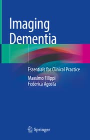 Cover von Imaging Dementia