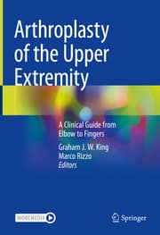 Cover von Arthroplasty of the Upper Extremity