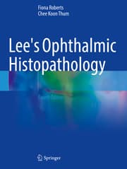 Cover von Lee's Ophthalmic Histopathology