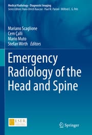 Cover von Emergency Radiology of the Head and Spine