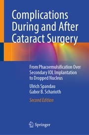Cover von Complications During and After Cataract Surgery