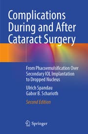 Cover von Complications During and After Cataract Surgery
