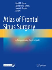 Cover von Atlas of Frontal Sinus Surgery
