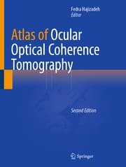 Cover von Atlas of Ocular Optical Coherence Tomography