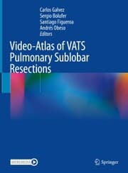 Cover von Video-Atlas of VATS Pulmonary Sublobar Resections