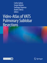Cover von Video-Atlas of VATS Pulmonary Sublobar Resections