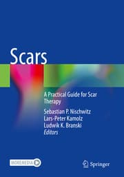Cover von Scars