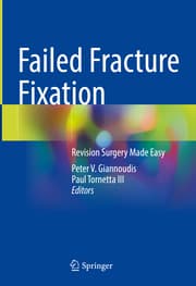 Cover von Failed Fracture Fixation