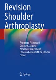 Cover von Revision Shoulder Arthroplasty