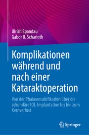 Cover von Komplikationen während und nach einer Kataraktoperation