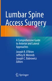 Cover von Lumbar Spine Access Surgery