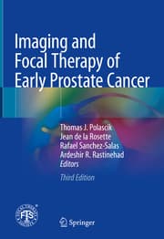 Cover von Imaging and Focal Therapy of Early Prostate Cancer