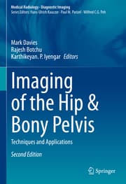 Cover von Imaging of the Hip & Bony Pelvis
