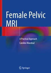 Cover von Female Pelvic MRI